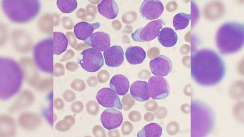 Post-treatment Cancer Detection Test Receives FDA Approval