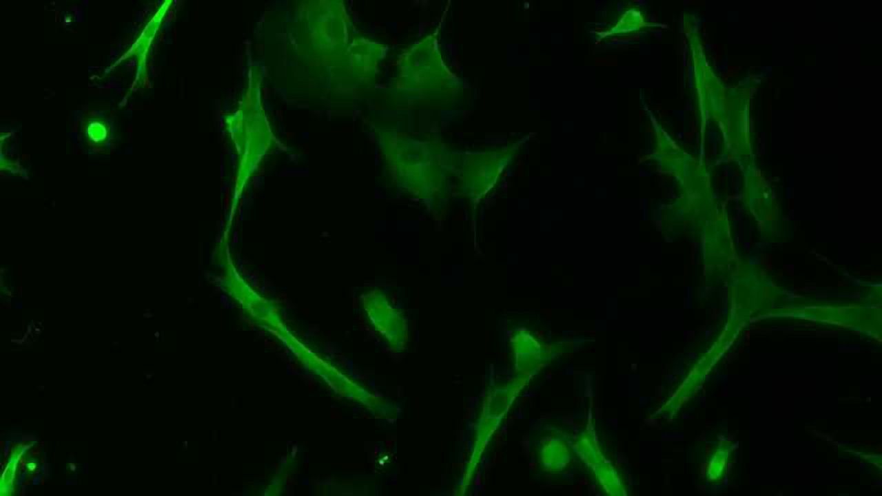 Developing Stem Cell Therapy Solutions for Liver Disease