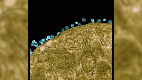 Latent Reservoir of HIV Targeted with Two-Pronged Approach