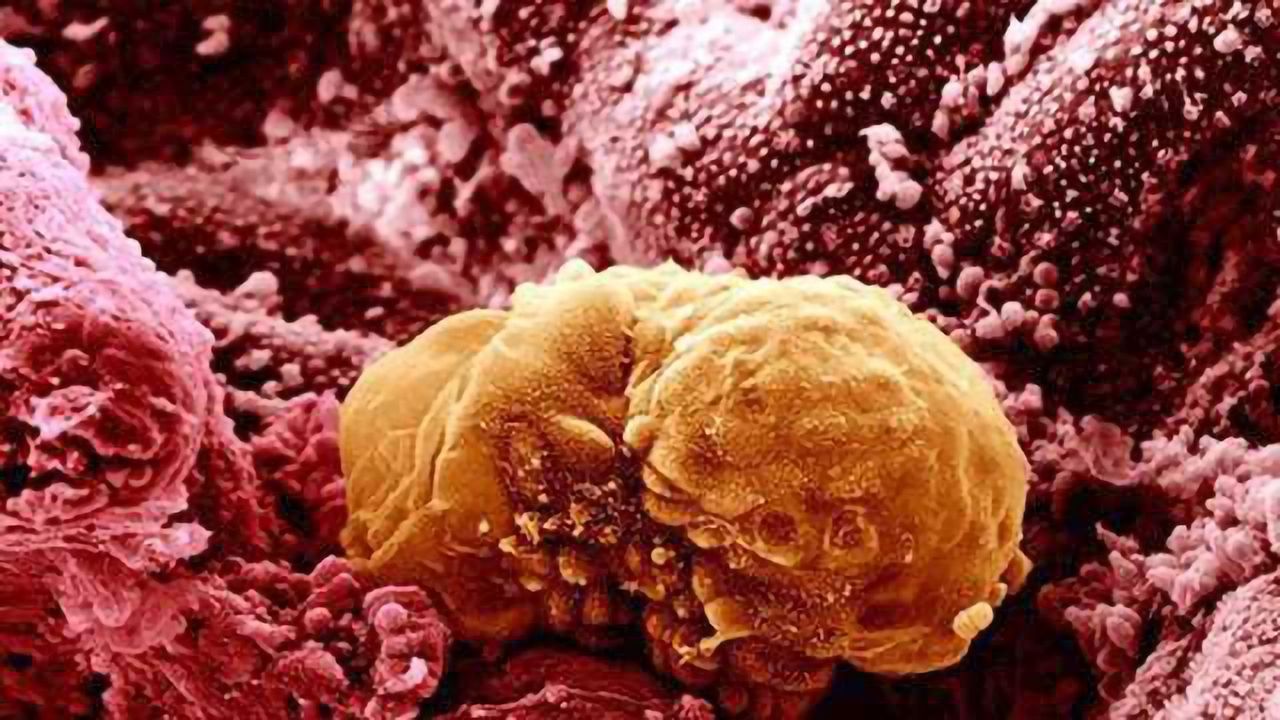 Transcription Roadblock Limits Entry of Epiblast Cells to the Germline