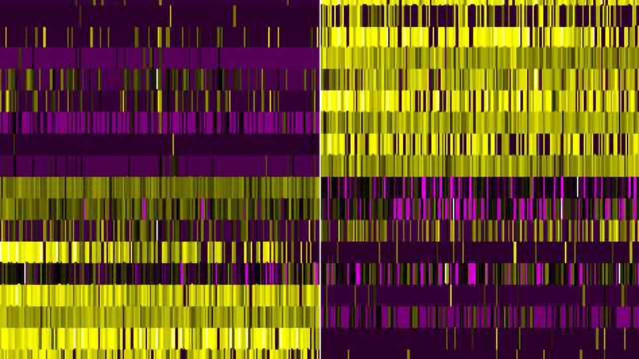Every Cell Has a Story to Tell in Brain Injury