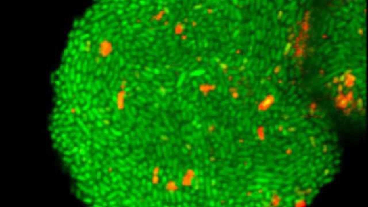 Revealing How Fatal Biofilms Form
