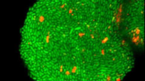 Revealing How Fatal Biofilms Form