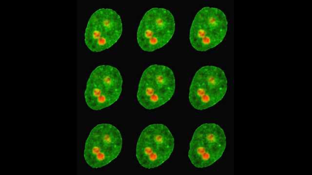Human Nucleoli Behave as Liquid Droplets