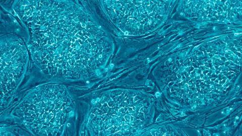 Spatiotemporal Self-patterning of Stem Cells Interrogated with CRISPR