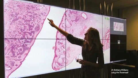 First Fully Digital Pathology Lab in UK Improves Cancer Diagnosis