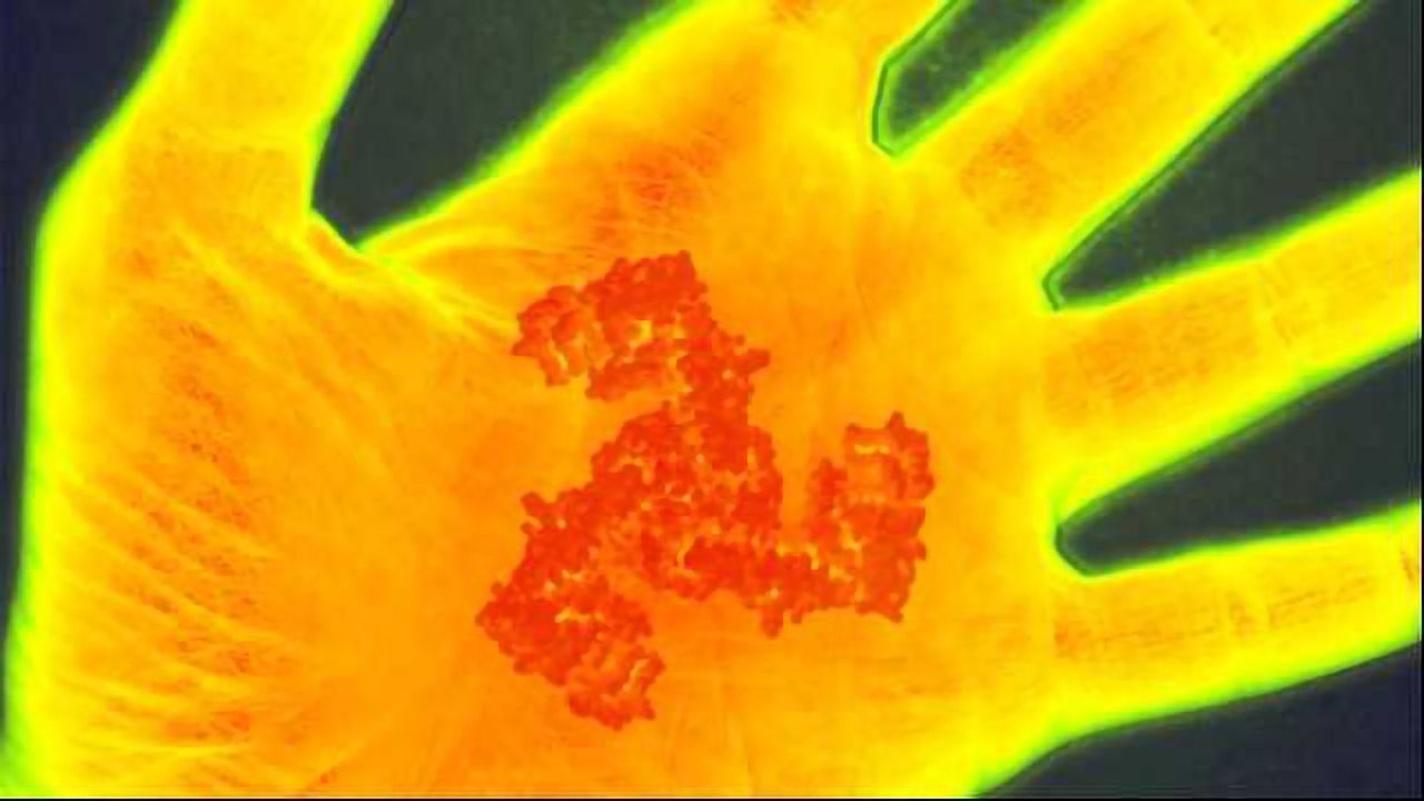 Feel Sensitive After Sunburn? This Gene May Be Why