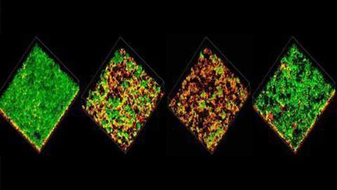 What Pneumococcus Says to Make You Sick