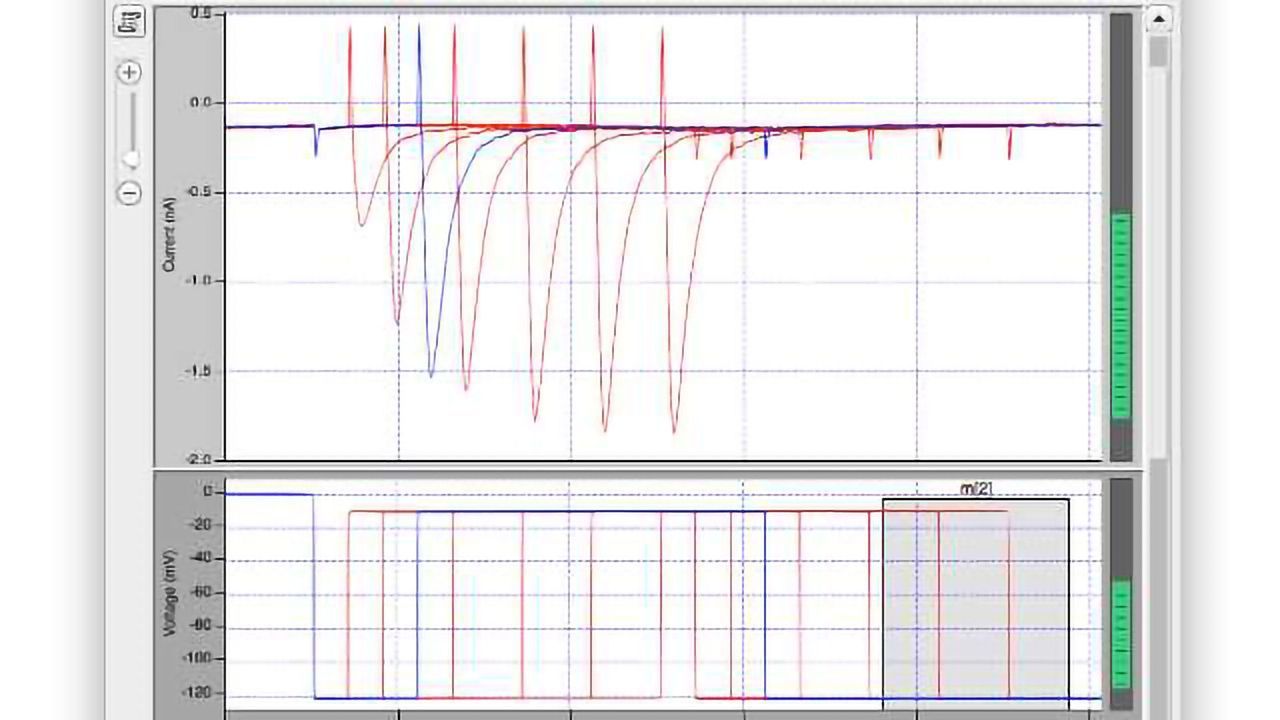 Electrophysiology Goes Digital