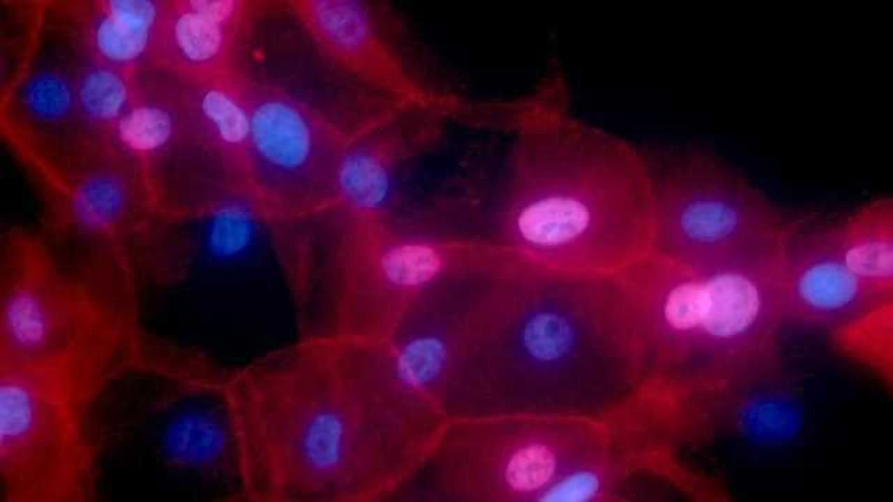 Having a Heavier First-Born or Shorter Pregnancy May Increase Mother’s Breast Cancer Risk