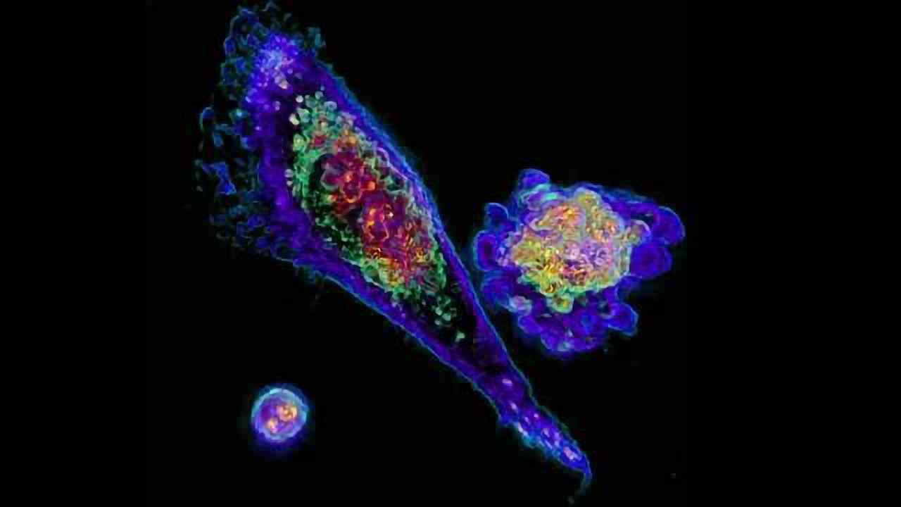 T Cell Actively Killing a Cancer Cell