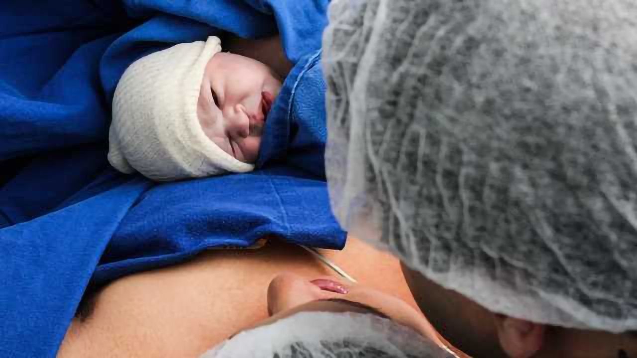 Cesarean-Born Mice Show Altered Patterns Of Brain Development