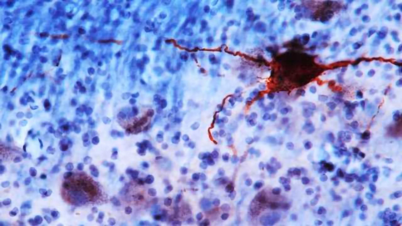 Study Suggests Biological Basis for Depression, Anxiety and Sleep Disturbances in Older Adults