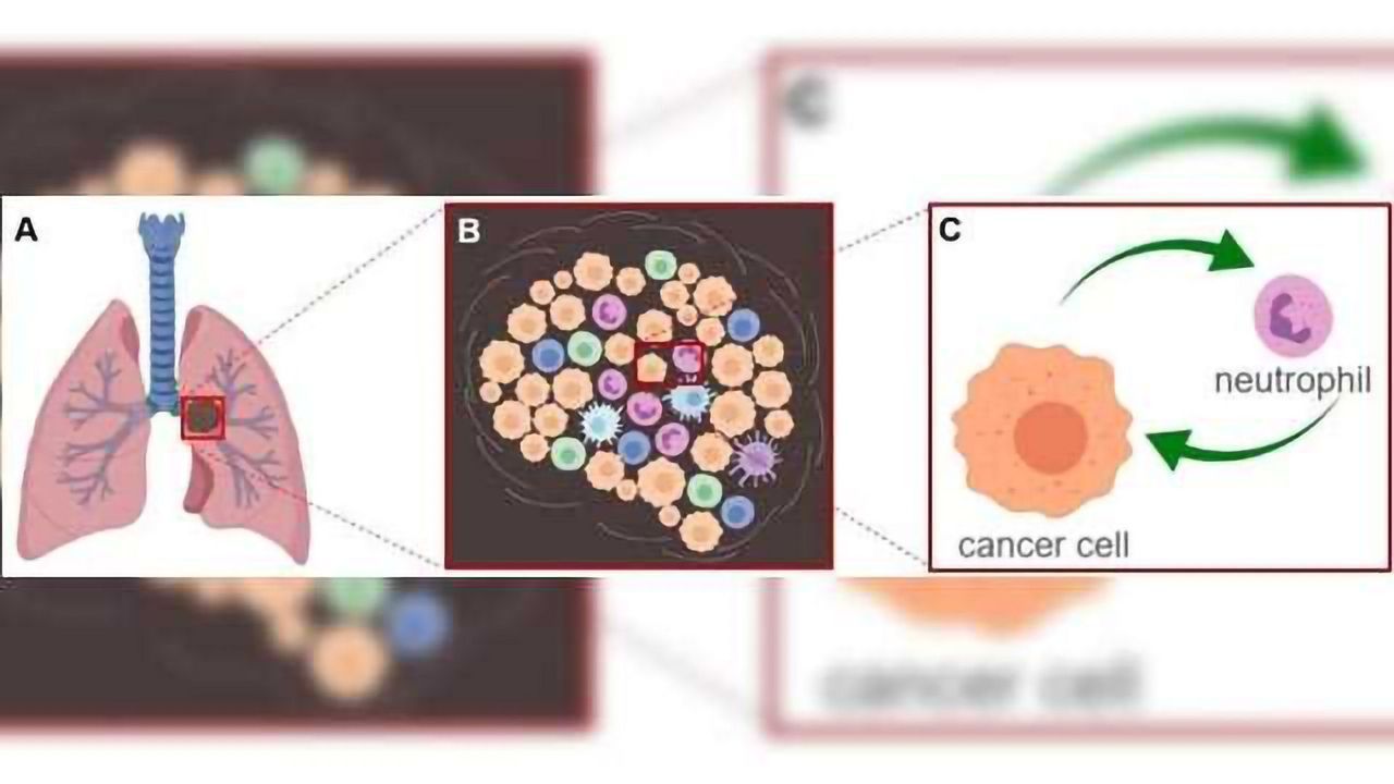 A Bad Influence: The Interplay Between Tumor & Immune Cells