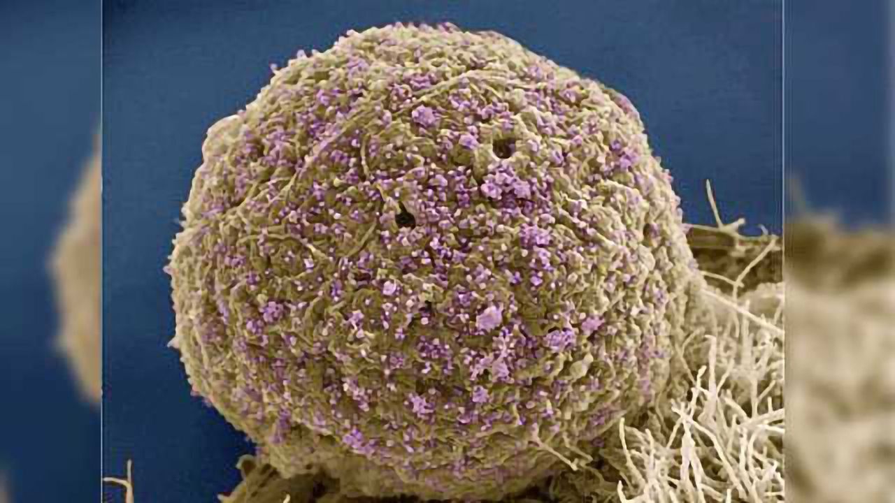 Antibody Combo Suppressed HIV Levels in Early Trial
