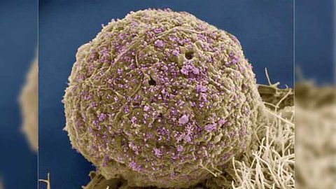 Antibody Combo Suppressed HIV Levels in Early Trial