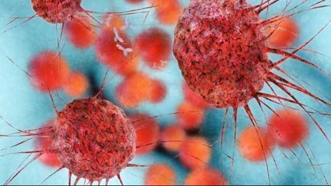 150-year-old Drug Could Improve Cancer Radiation Therapy