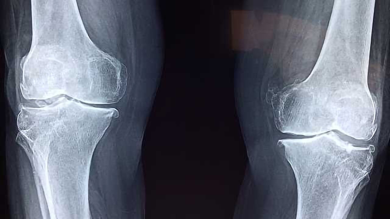 Taking a Better Look at Joint Damage