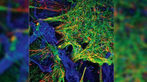 Functioning 3D Human Neural Networks Developed From Stem Cells
