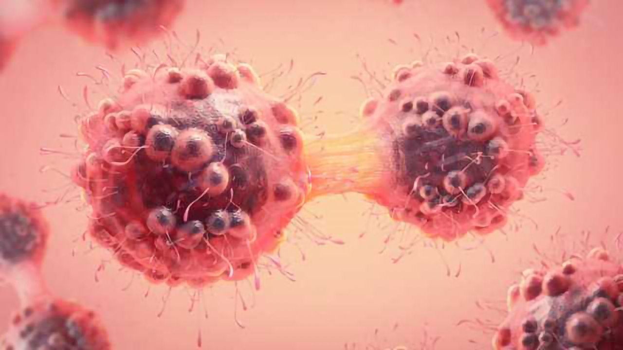 Immunotherapy Success for Triple-Negative Breast Cancer