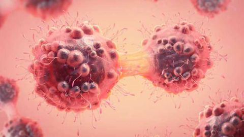 Immunotherapy Success for Triple-Negative Breast Cancer