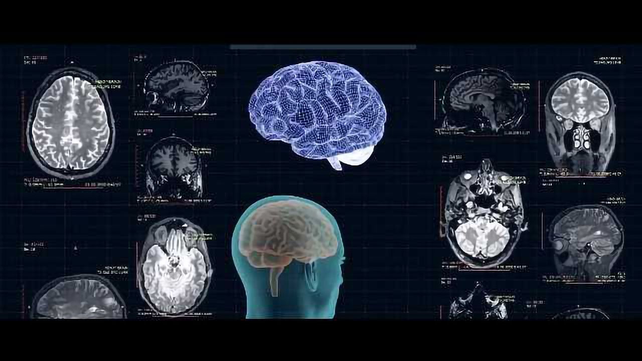 Grant Brings Ultrasound Therapy for Neurological Disease a Step Closer