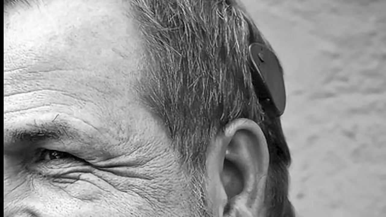 Progress in Cochlear Regeneration