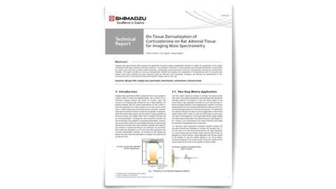 Transforming Imaging Mass Spectrometry with On-Tissue Derivatization