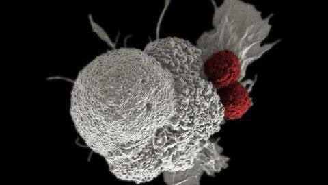 Immunotherapy Effective as First-line Treatment for Advanced Head & Neck Cancer