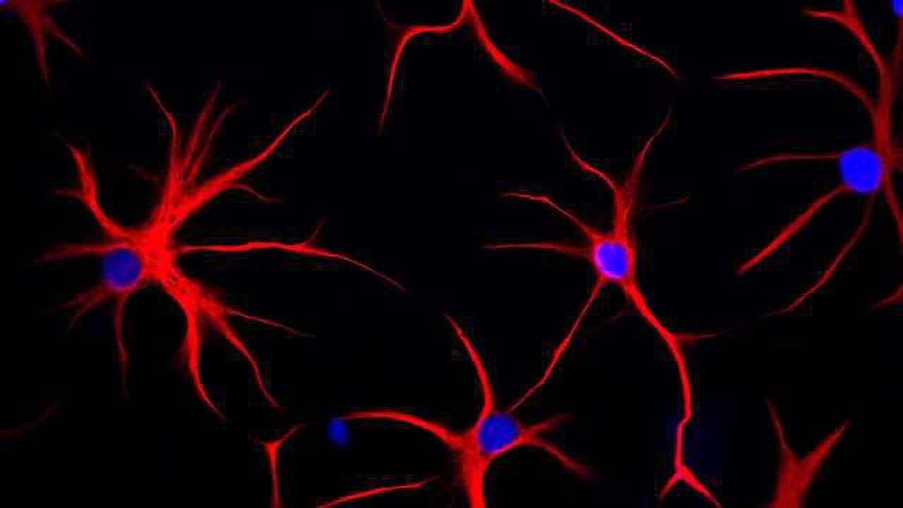 GFAP Astrocyte Mutation Triggers Chaos in Brain Cells
