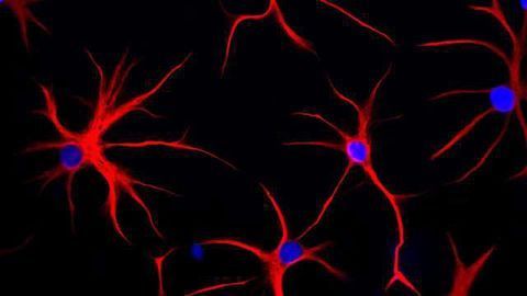 GFAP Astrocyte Mutation Triggers Chaos in Brain Cells