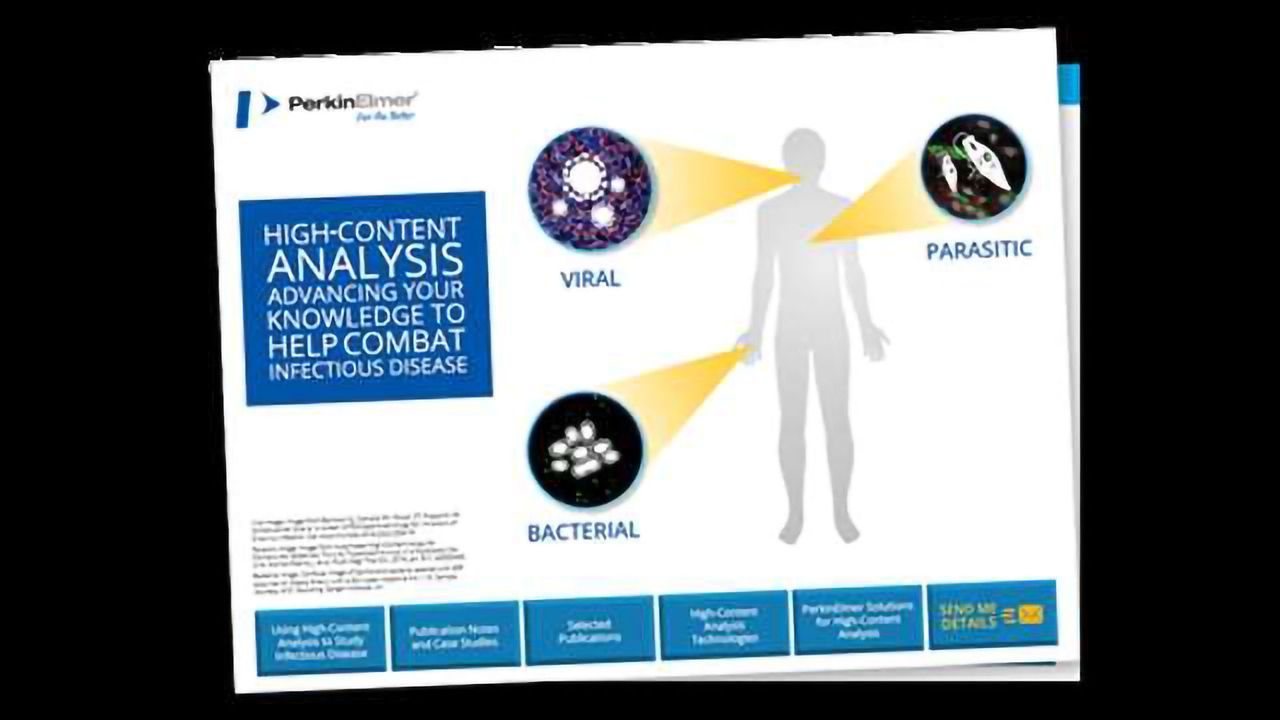 Studying Infectious Diseases with High-Content Analysis