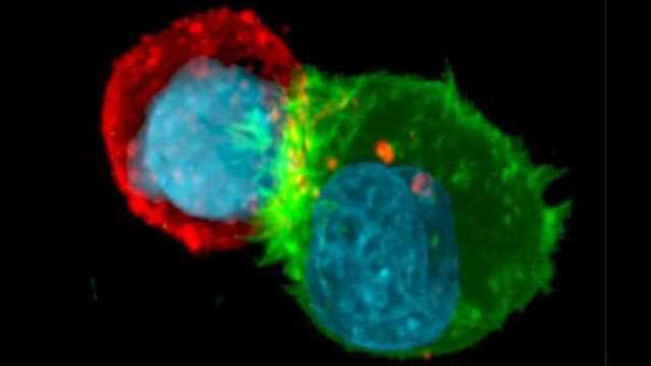 Actin(g) as Protection for Tumor Cells Under Immune Attack