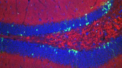 Aged Hippocampal Signalling Pathway Improved in Rodents