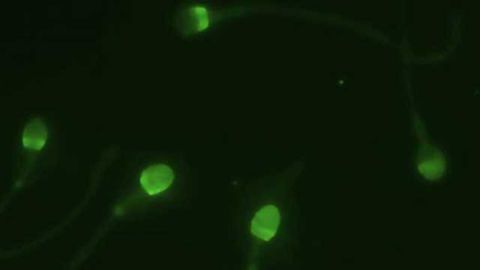 New Test Measures Men's Fertility