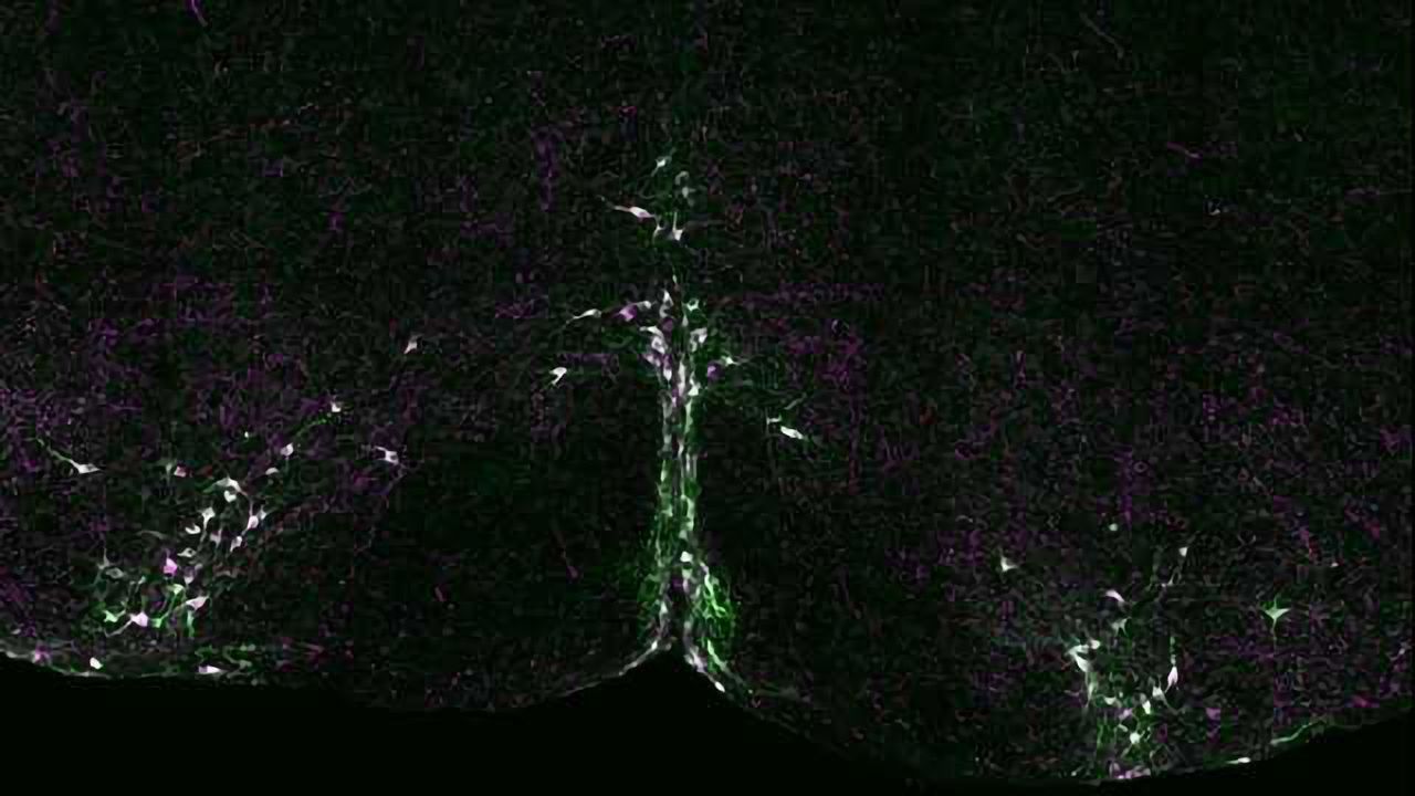 Serotonin Signaling Implicated in SIDS Research
