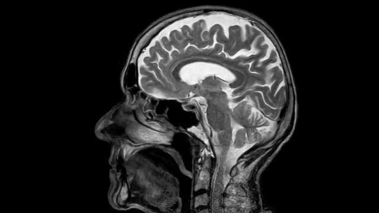 Bigger Brains, Bigger Cancer Risk