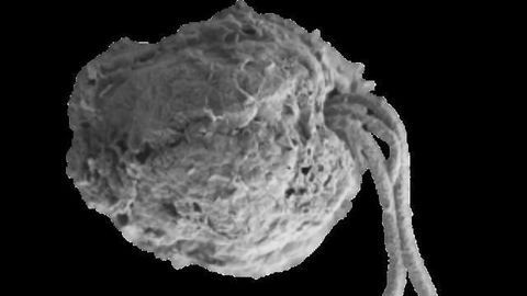Sugar Discovery Could Help Battle Against Toxic Algal Blooms