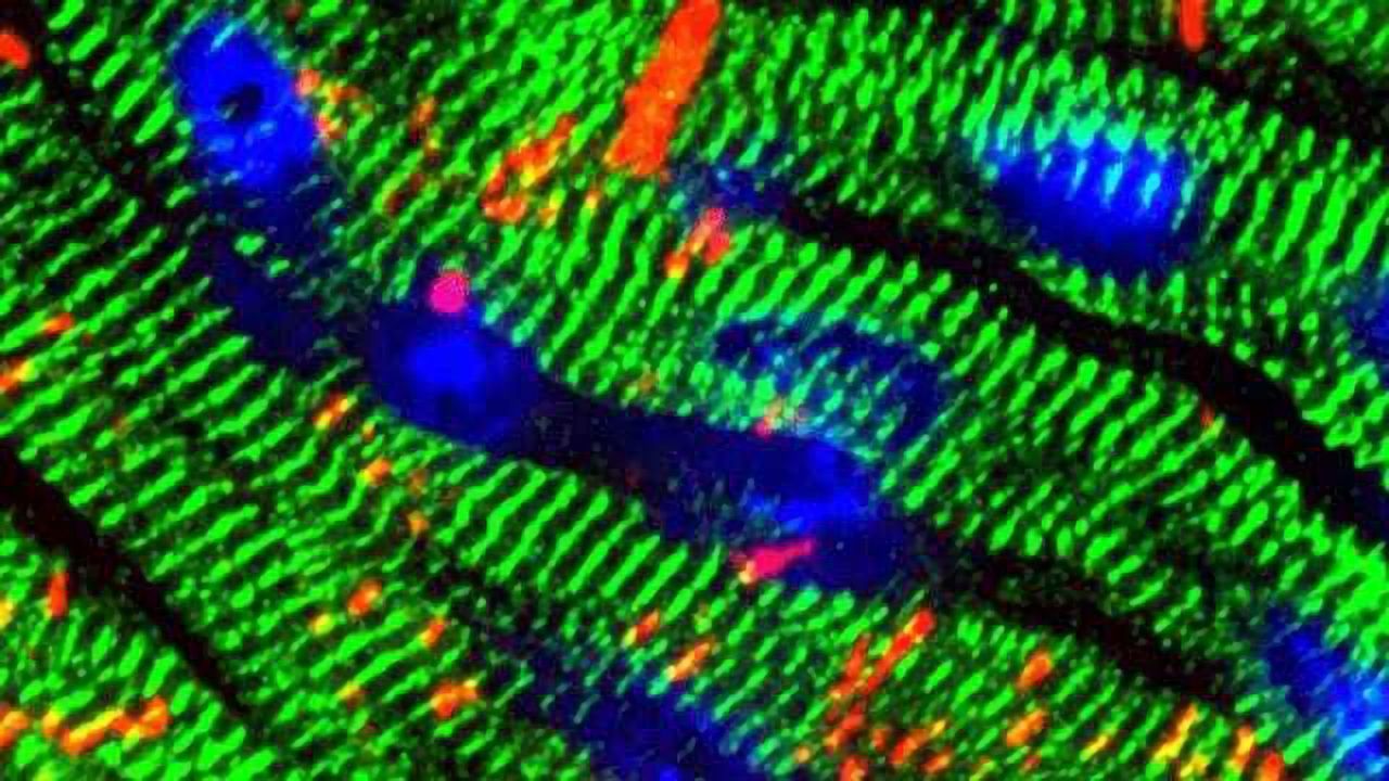 Biomarker for Most Common Form of Heart Failure