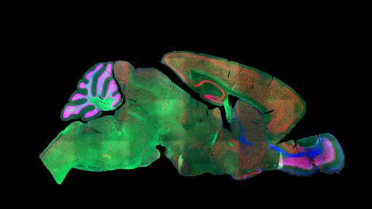 In-Depth Analysis Sorts Mouse Cortex into 133 "Cell Types"