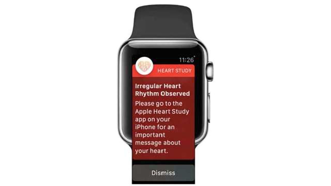 Heart-Rhythm Trial Launched: An Apple-Stanford Collaboration