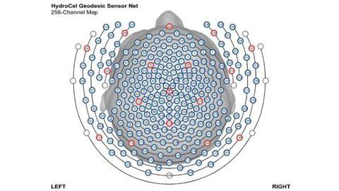 Making Sense of Brainwaves