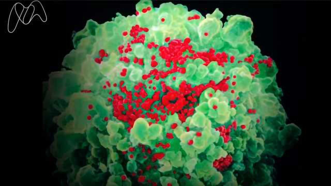 Developing an HIV Vaccine