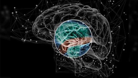Risk Factors for Schizophrenia Lie in Brain Network Organization