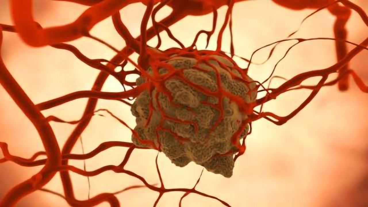 AMPK Enzyme Thought to Suppress Cancer Actually Helps Some Tumors Survive