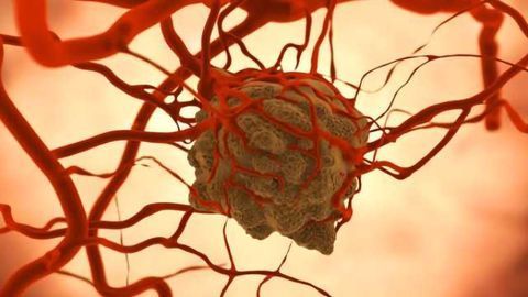 AMPK Enzyme Thought to Suppress Cancer Actually Helps Some Tumors Survive