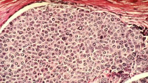 Hidden Estrogen Receptors in the Breast Epithelium