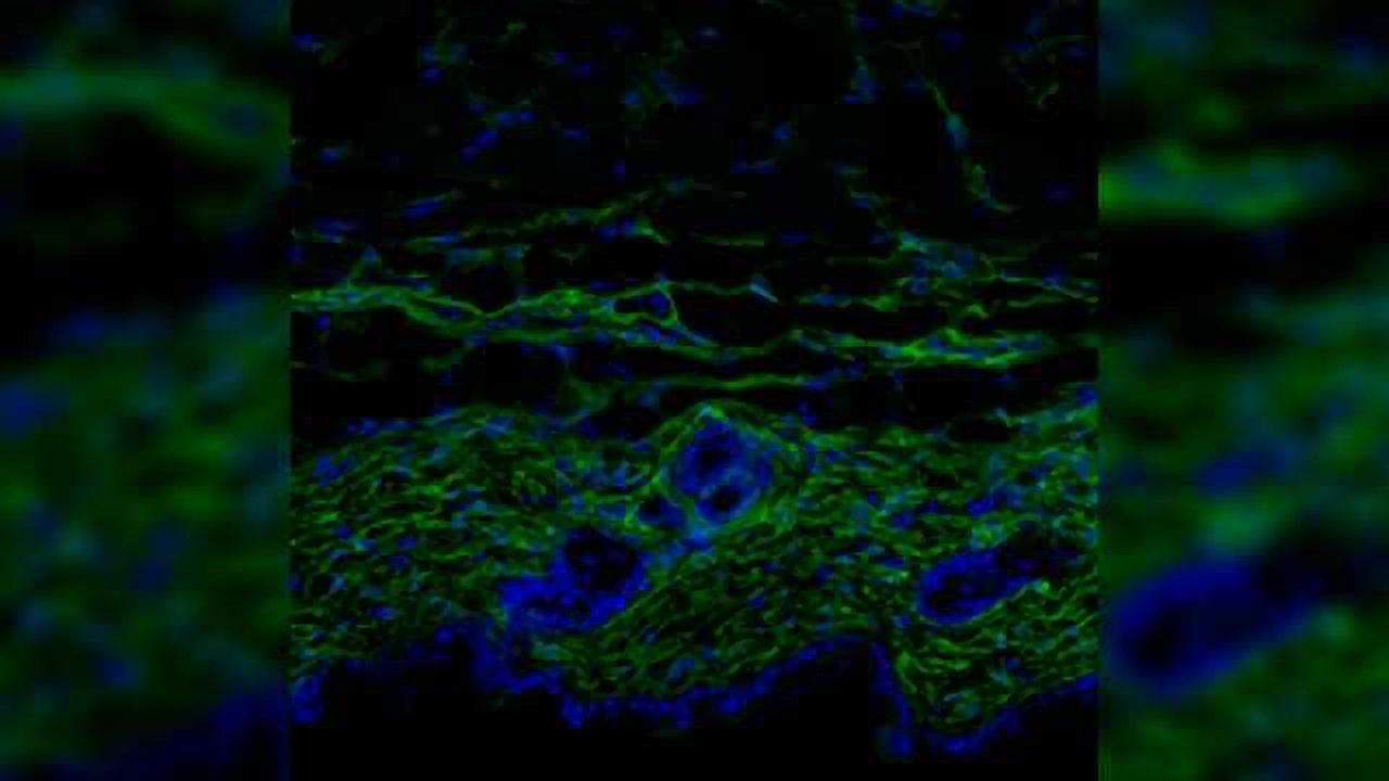 Dermal Fibroblasts Gain Adipogenic Traits with Age