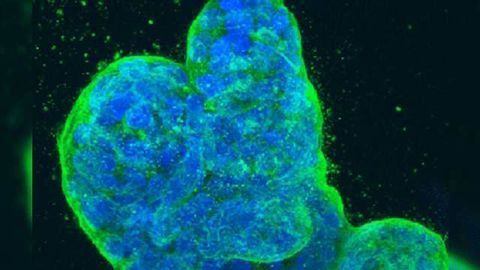 OncRNAs Present Pathology Insights and Diagnostic Opportunities