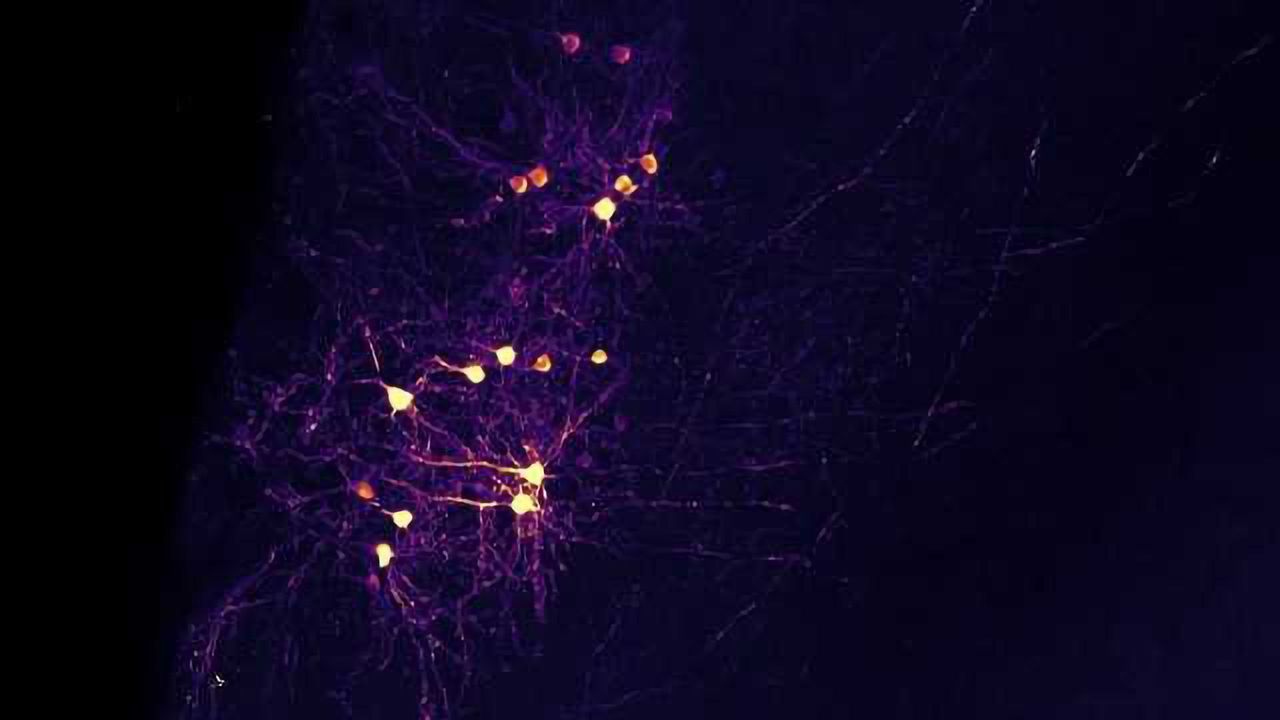 Neurons that Fire Together, Wire Together? Not Always